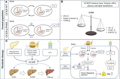 Glucokinase regulatory protein: a balancing act between glucose and lipid metabolism in NAFLD